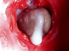 Mini-camera In the Butthole: Intense Anal Orgasm With a Creampie Is Shown From the Inside